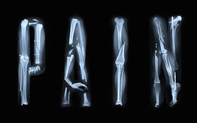X-ray typography with bone structure, technical, 3d-render, high-contrast