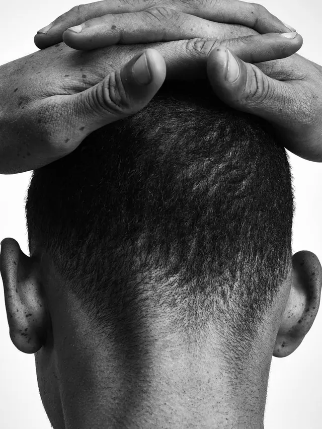 Close-up Portrait of Hands on Head