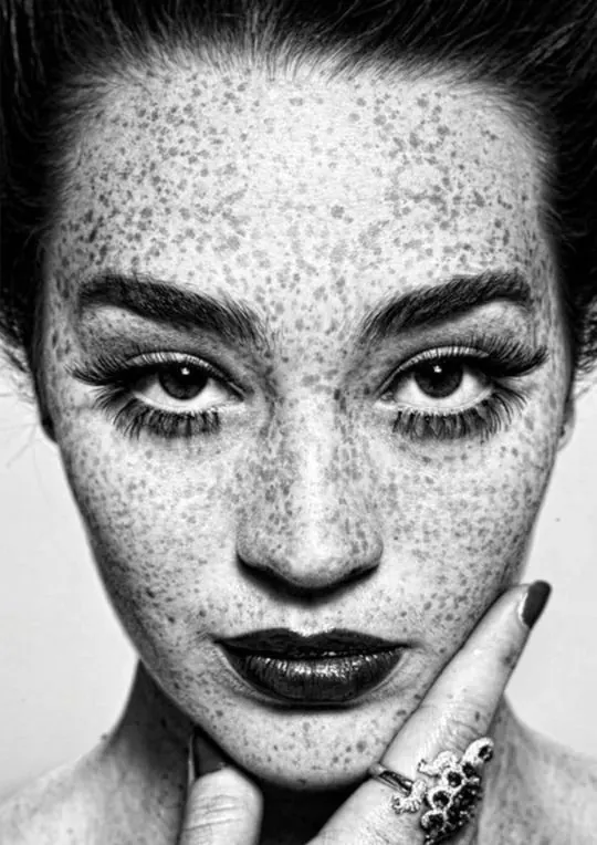 High-Contrast Portrait with Freckles