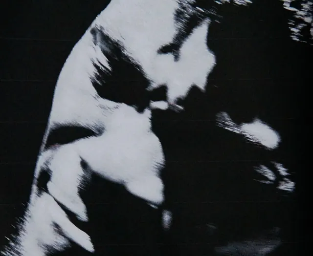 High-Contrast Monochrome Portrait