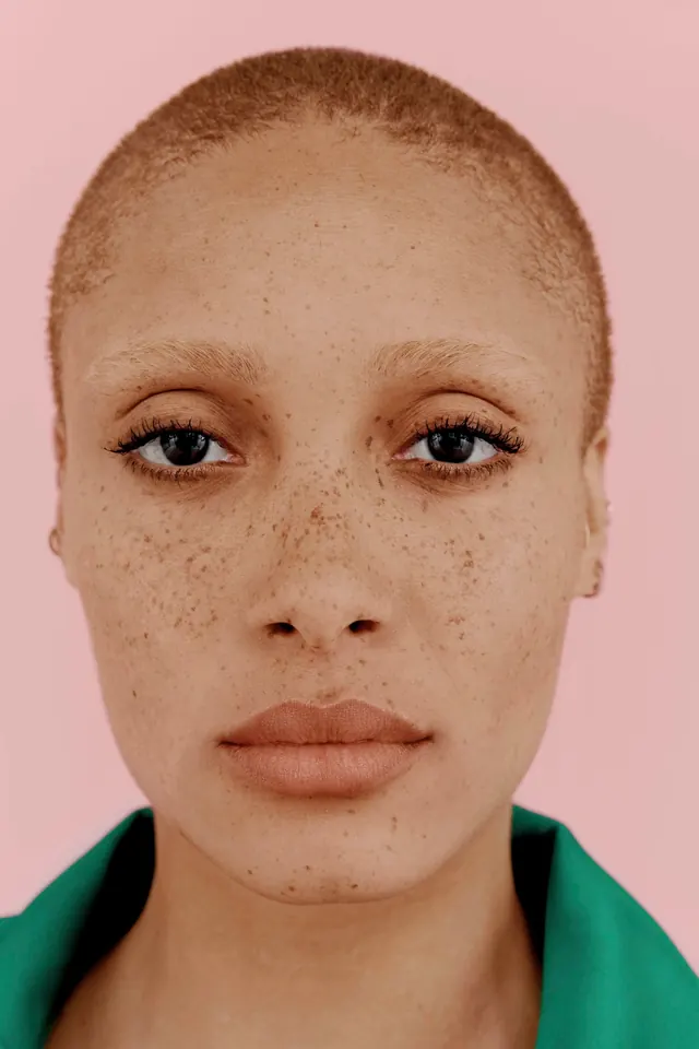Portrait of a Person with Freckles