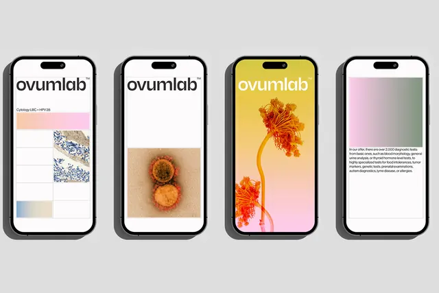 Ovumlab diagnostic mobile app screens mockup, minimal, flat, light